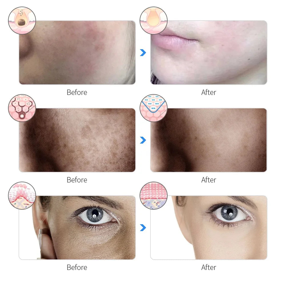 7-Color LED Facial Beauty Mask